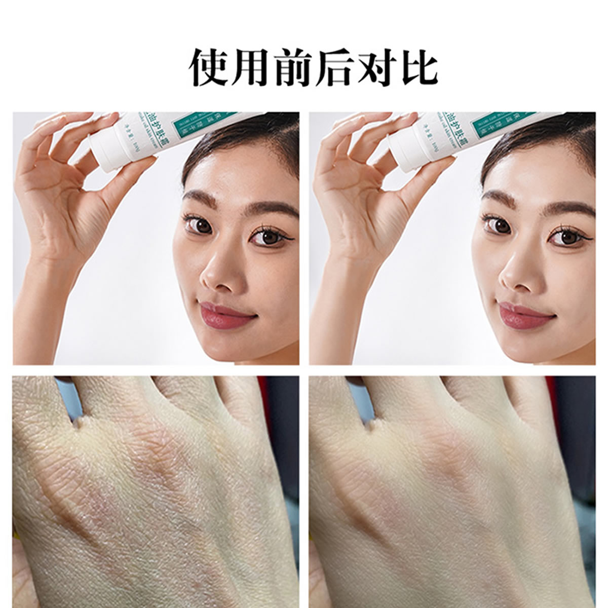 蛇师傅蛇油护肤霜、使用前后对比 蛇师傅蛇油护肤霜、使用前后对比