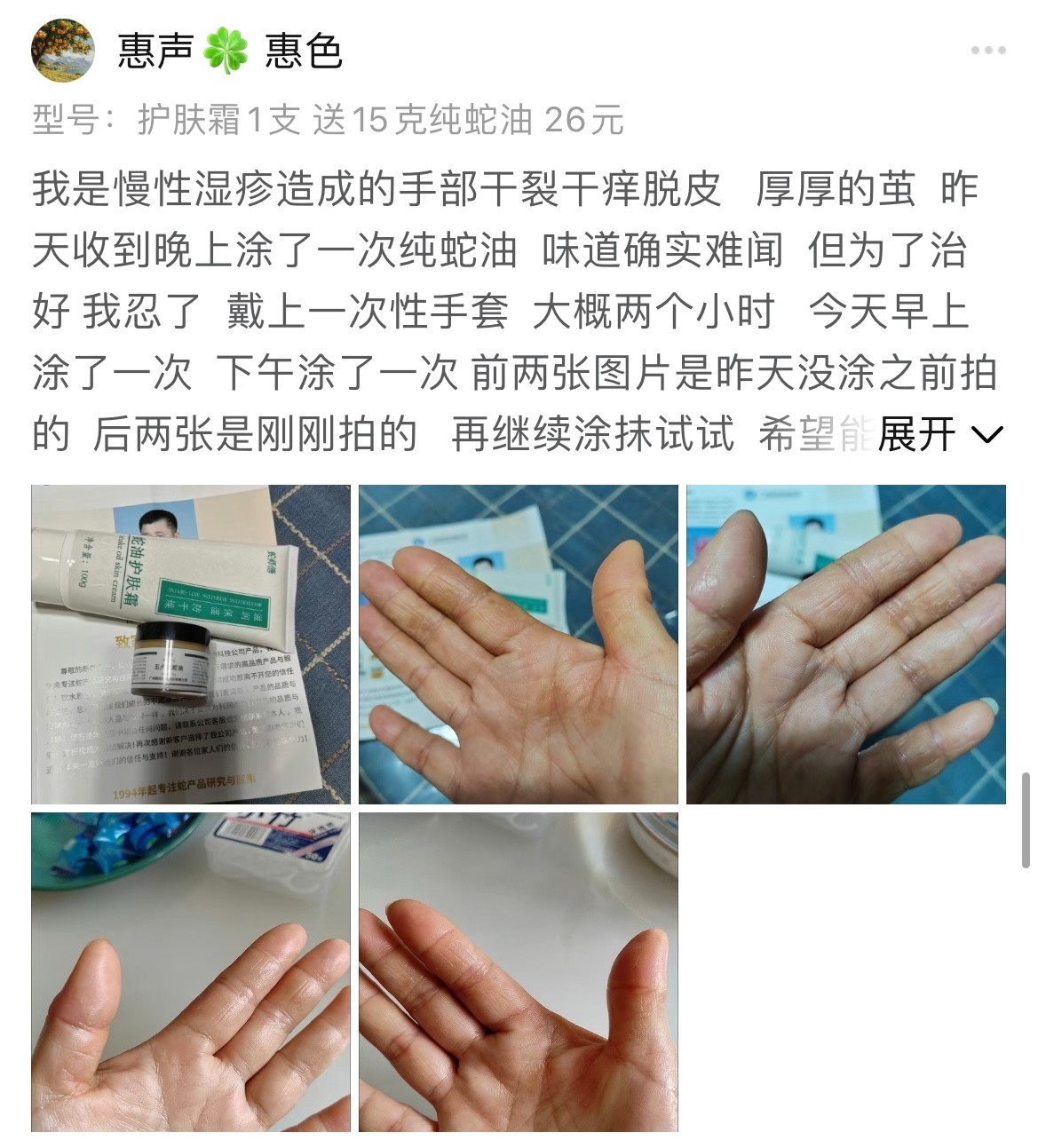 蛇师傅蛇油护肤霜客户使用后评价
