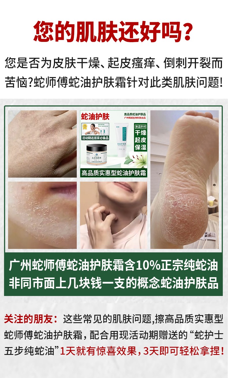 超值3支套装 蛇师傅蛇油护肤霜